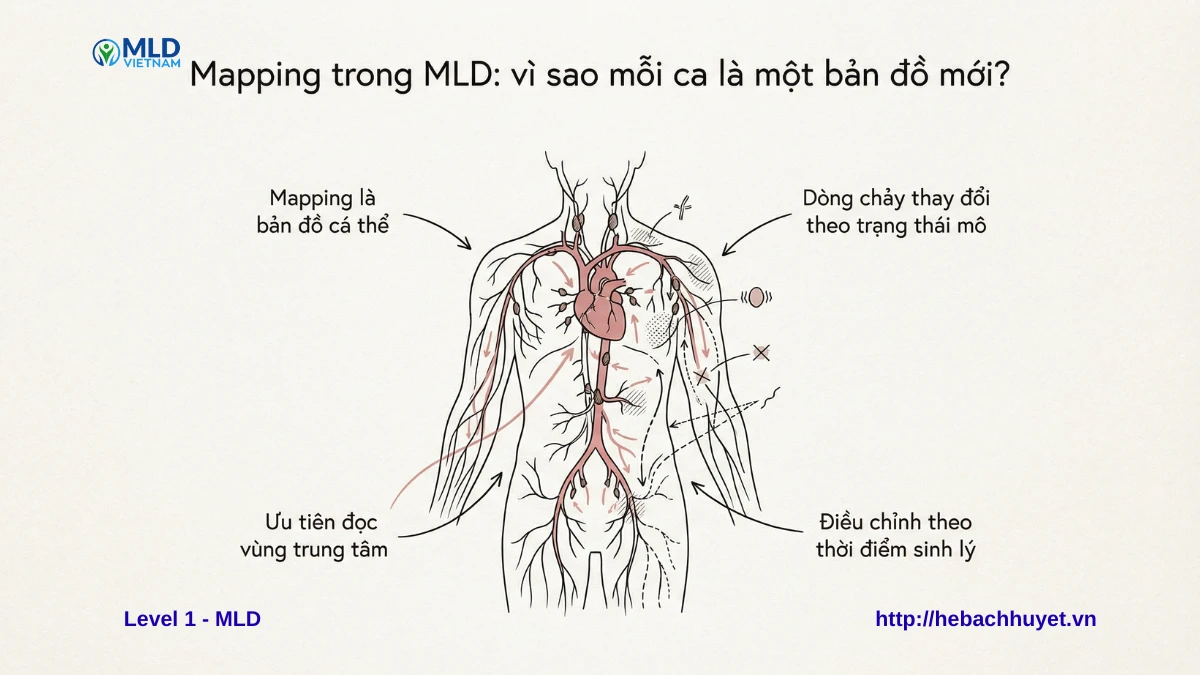 Mapping trong MLD là gì? Vì sao mỗi ca dẫn lưu bạch huyết là một bản đồ hoàn toàn mới